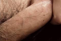 113