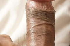 176