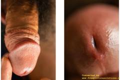 HORMONE-19-中册-45